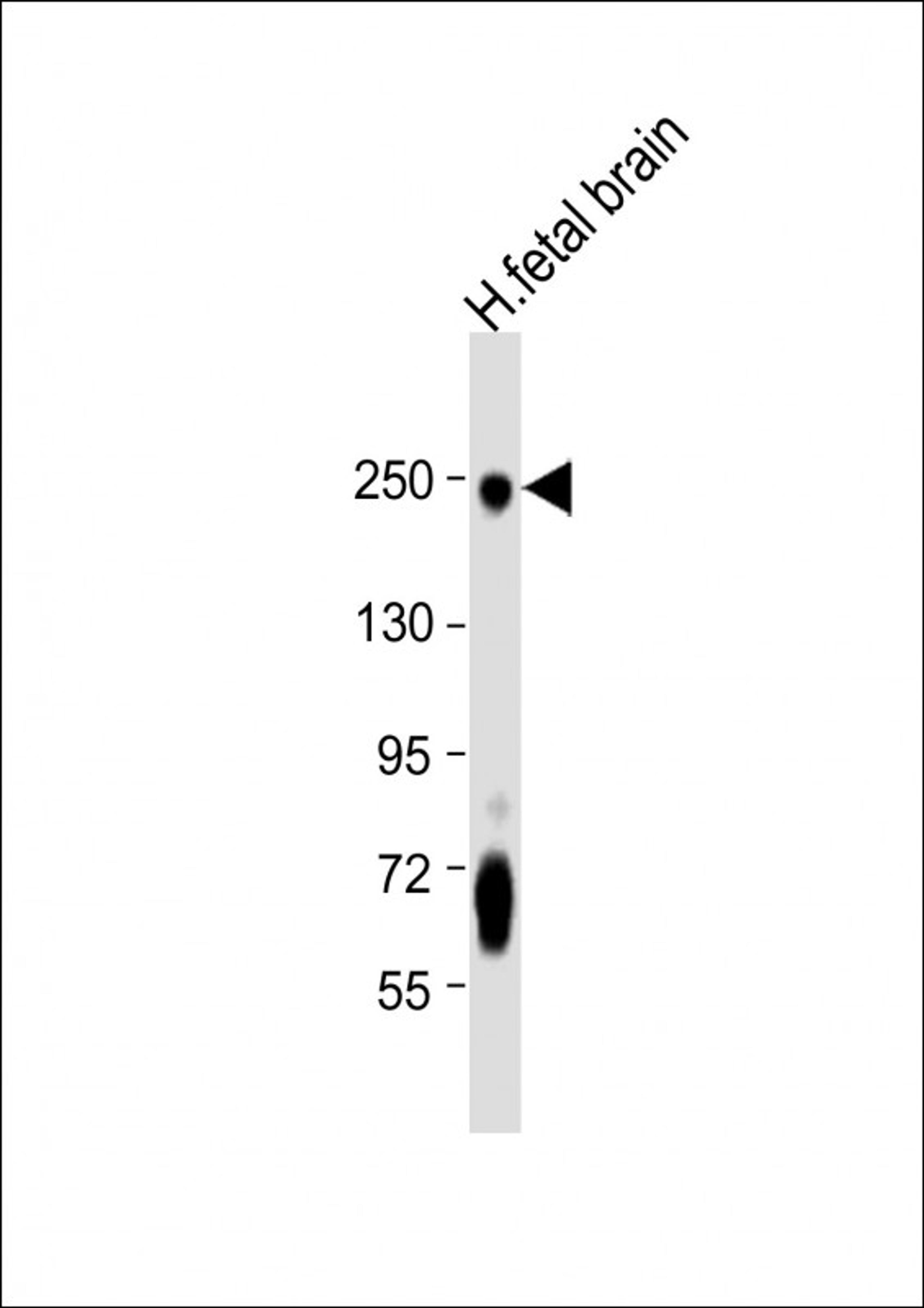 Western Blot at 1:8000 dilution + human fetal brain lysate Lysates/proteins at 20 ug per lane.