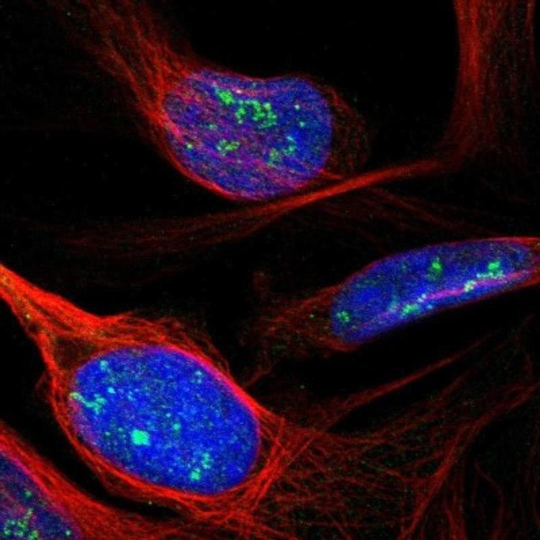 Immunocytochemistry/Immunofluorescence: BPGM Antibody [NBP1-86064] - Immunofluorescent staining of human cell line U-2 OS shows positivity in nucleus & nucleoli.