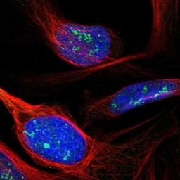 Immunocytochemistry/Immunofluorescence: BPGM Antibody [NBP1-86064] - Immunofluorescent staining of human cell line U-2 OS shows positivity in nucleus & nucleoli.