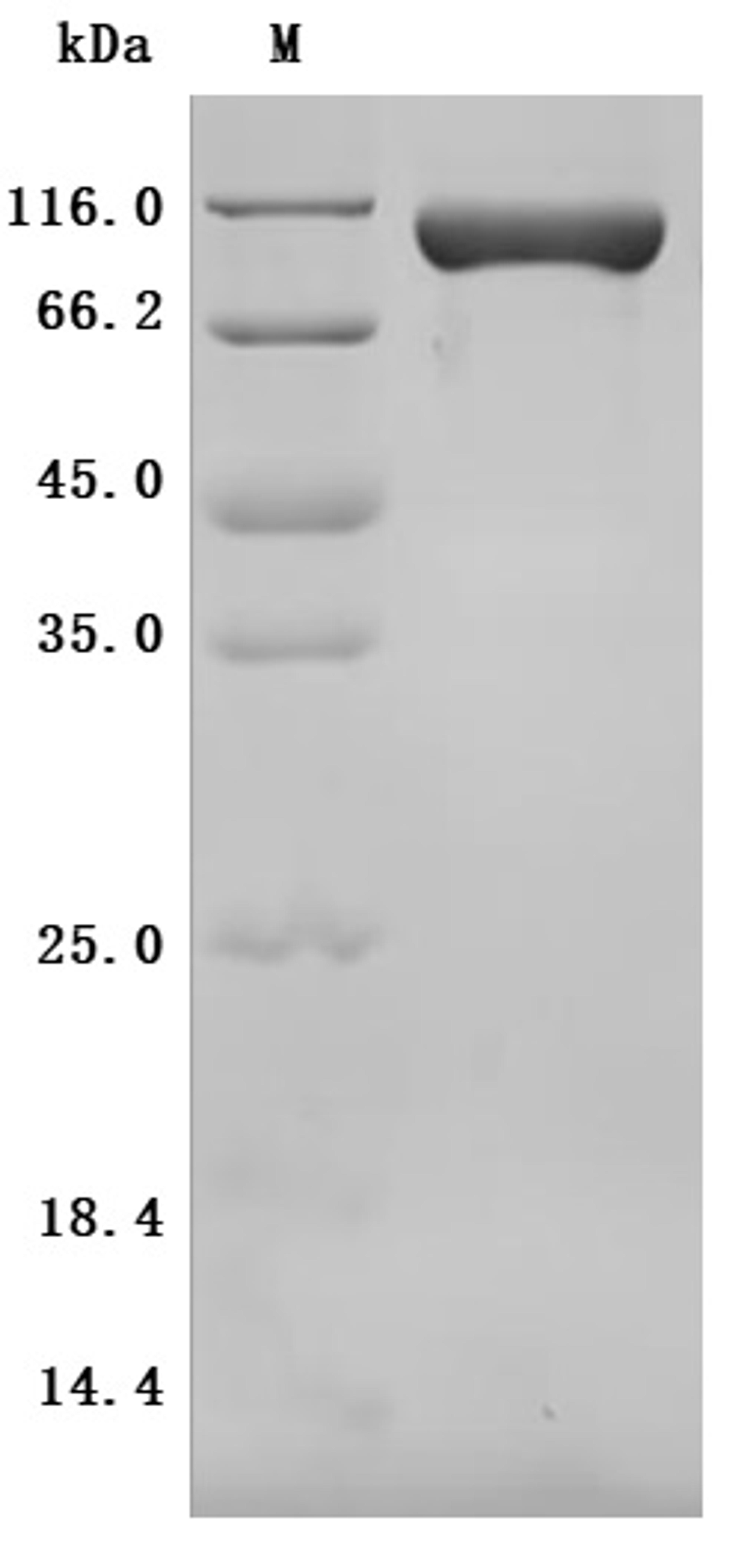 (Tris-Glycine gel) Discontinuous SDS-PAGE (reduced) with 5% enrichment gel and 15% separation gel.