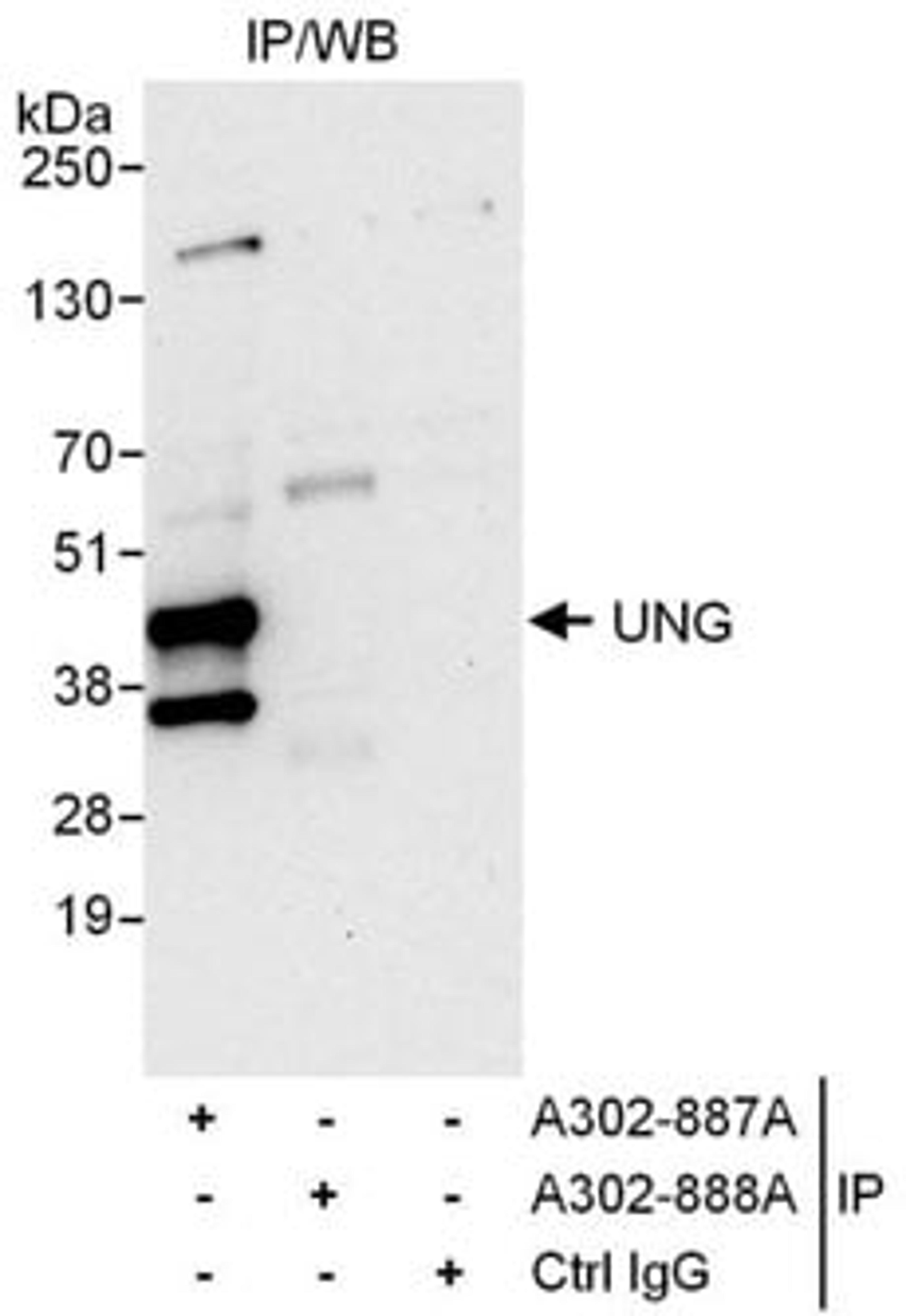 Detection of human UNG by western blot of immunoprecipitates.