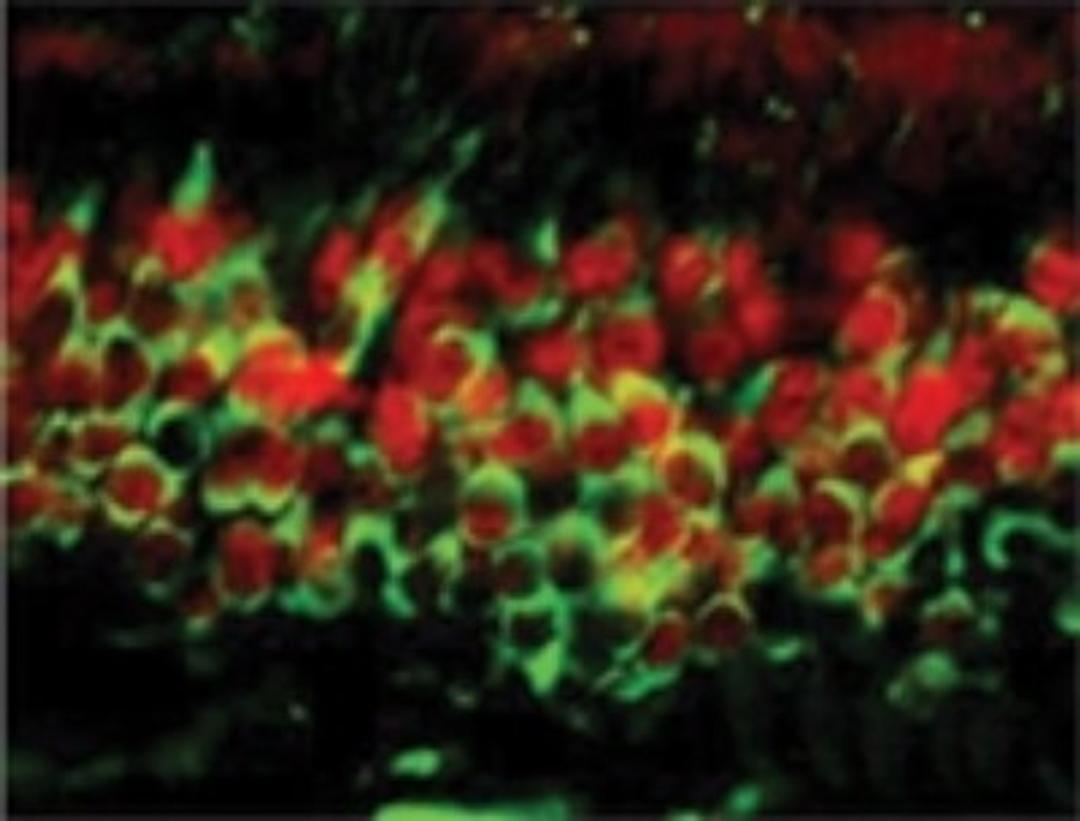 Immunocytochemistry/Immunofluorescence: Dnmt3a Antibody (64B1446) [NB120-13888] - Expression of Dnmt3a in the nuclei of post-mitotic neurons in the olfactory epithelium (OE). DNMT3a (red) is co-expressed with neuron-specific tubulin (green) throughout the development of the olfactory epithelium. (Data courtsey of A. Jane Roskams, University of British Columbia).