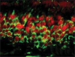 Immunocytochemistry/Immunofluorescence: Dnmt3a Antibody (64B1446) [NB120-13888] - Expression of Dnmt3a in the nuclei of post-mitotic neurons in the olfactory epithelium (OE). DNMT3a (red) is co-expressed with neuron-specific tubulin (green) throughout the development of the olfactory epithelium. (Data courtsey of A. Jane Roskams, University of British Columbia).