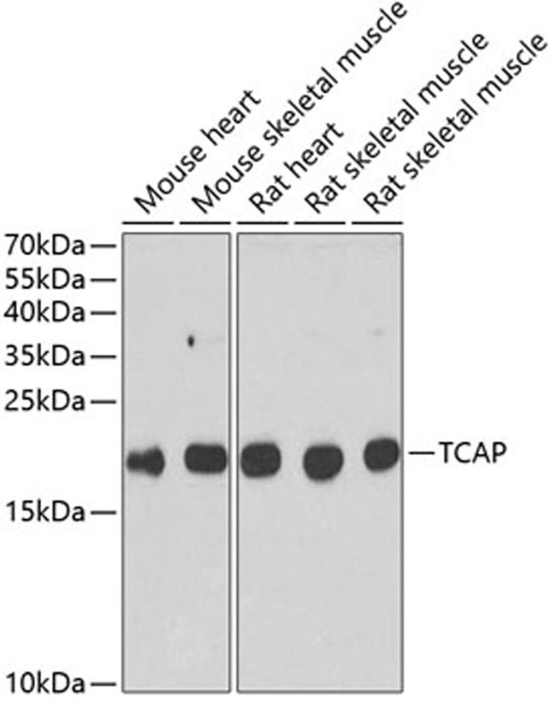 Western blot - TCAP antibody (A6765)