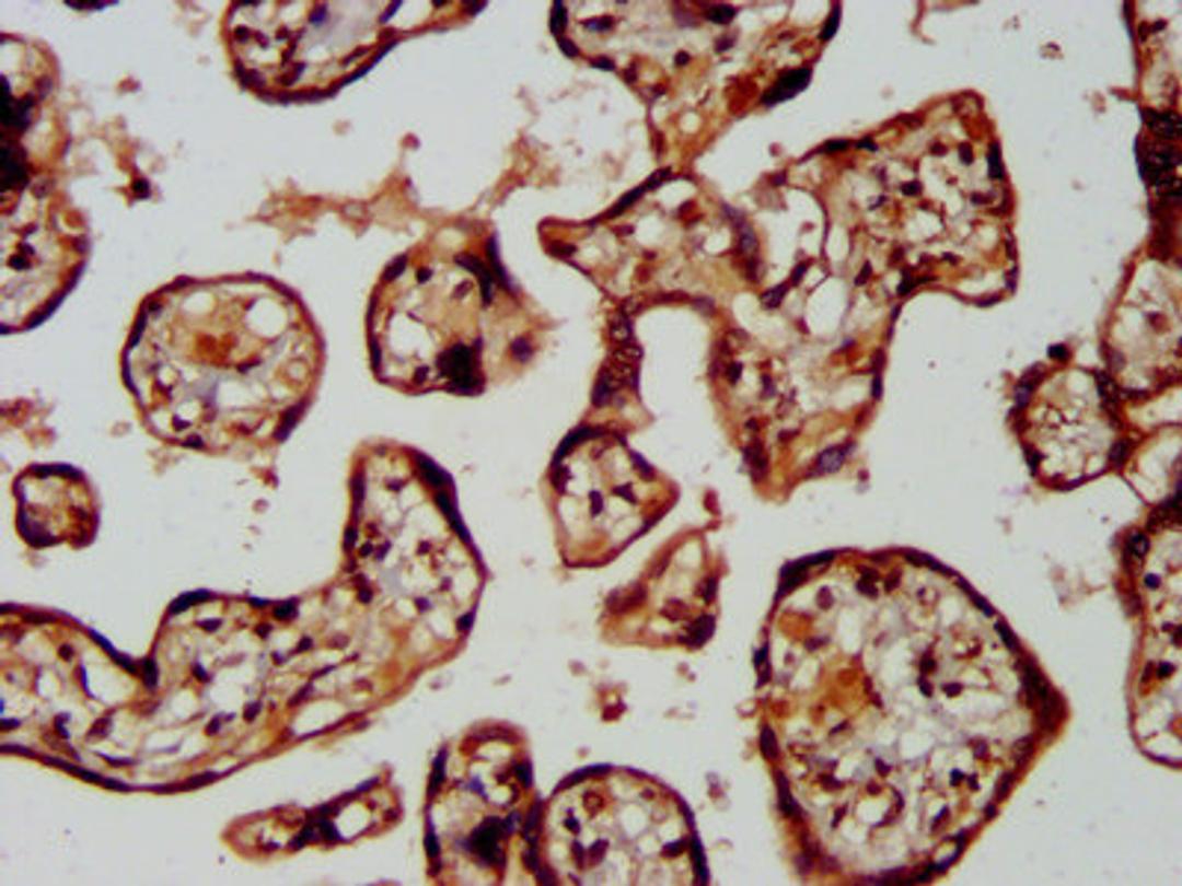 IHC image of CSB-PA850272LA01HU diluted at 1:400 and staining in paraffin-embedded human placenta tissue performed on a Leica BondTM system. After dewaxing and hydration, antigen retrieval was mediated by high pressure in a citrate buffer (pH 6.0). Section was blocked with 10% normal goat serum 30min at RT. Then primary antibody (1% BSA) was incubated at 4°C overnight. The primary is detected by a biotinylated secondary antibody and visualized using an HRP conjugated SP system.