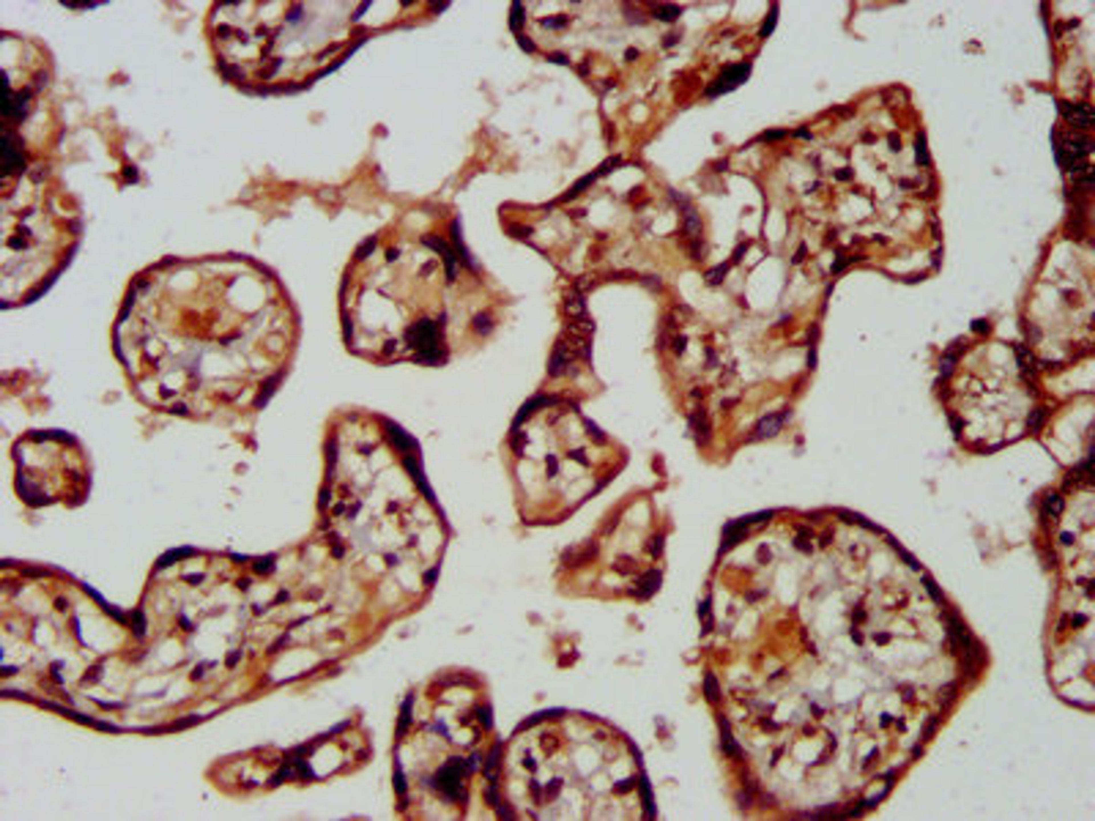 IHC image of CSB-PA850272LA01HU diluted at 1:400 and staining in paraffin-embedded human placenta tissue performed on a Leica BondTM system. After dewaxing and hydration, antigen retrieval was mediated by high pressure in a citrate buffer (pH 6.0). Section was blocked with 10% normal goat serum 30min at RT. Then primary antibody (1% BSA) was incubated at 4°C overnight. The primary is detected by a biotinylated secondary antibody and visualized using an HRP conjugated SP system.