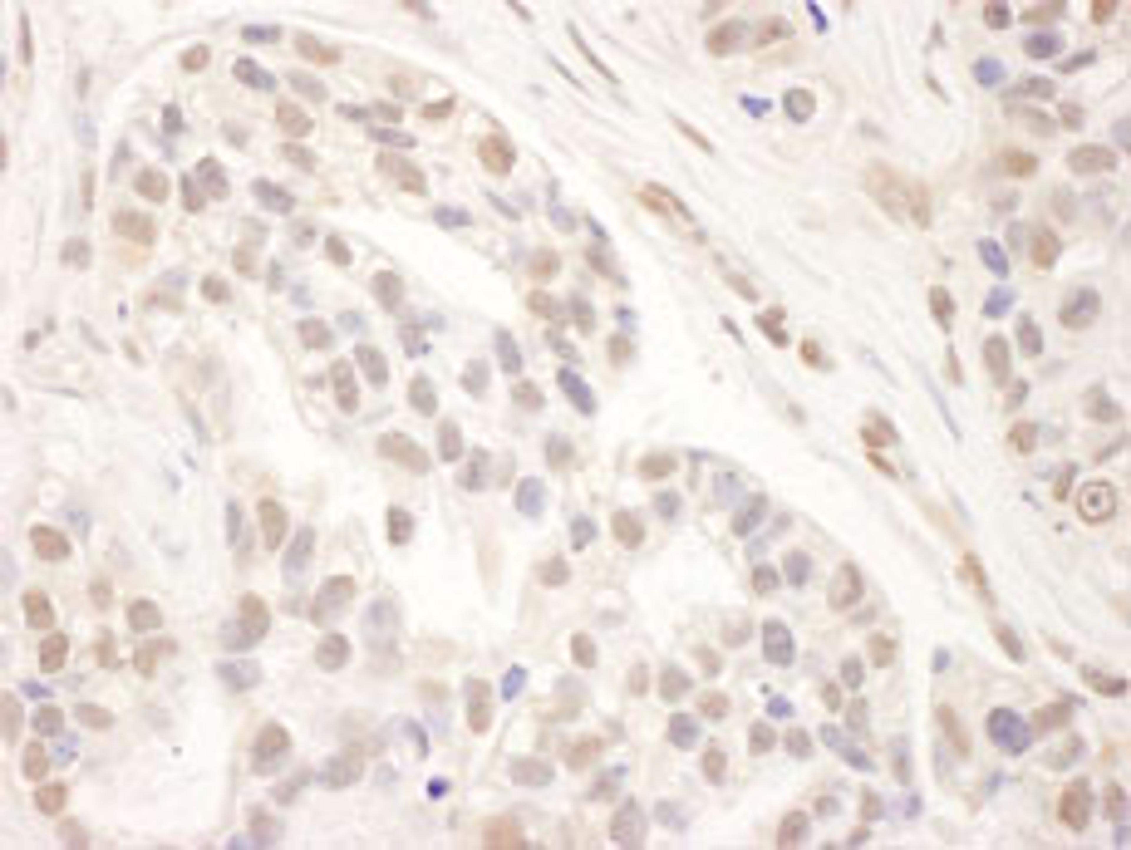 Detection of human MED1 by immunohistochemistry.