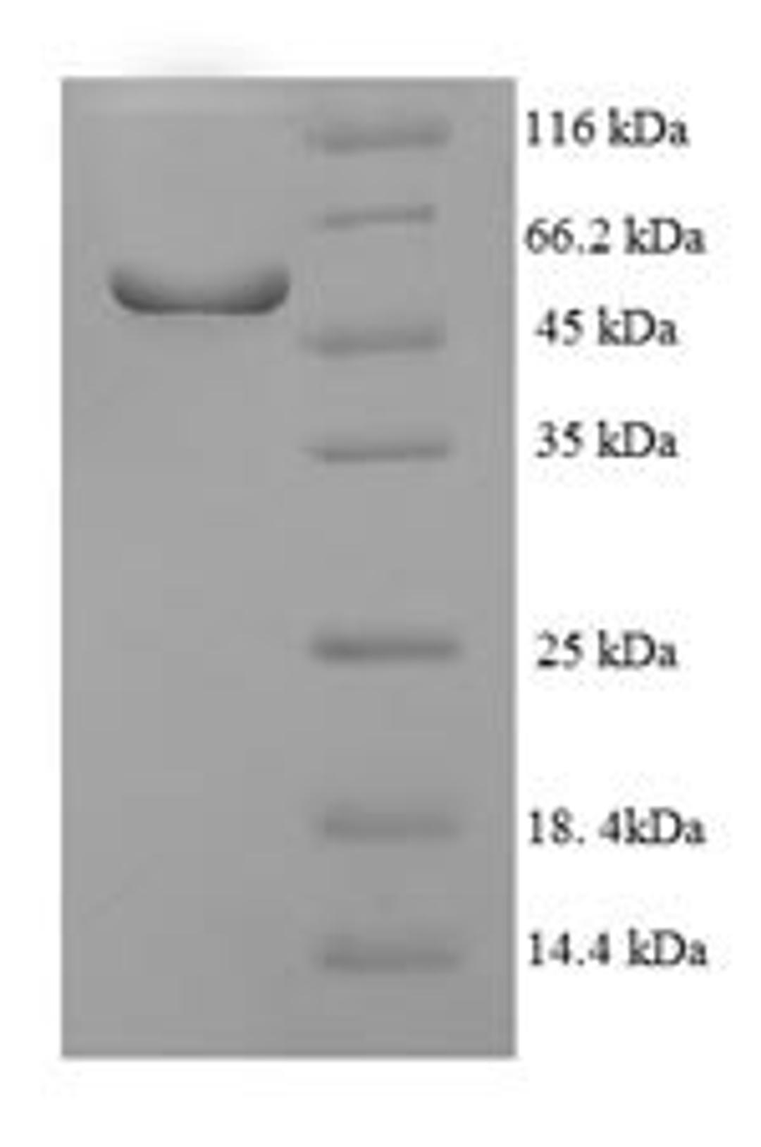 (Tris-Glycine gel) Discontinuous SDS-PAGE (reduced) with 5% enrichment gel and 15% separation gel.