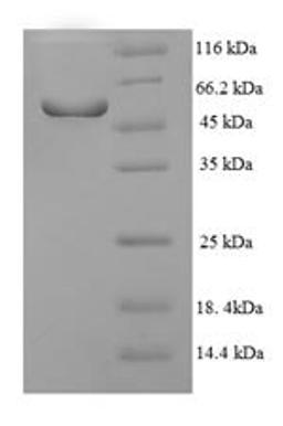 (Tris-Glycine gel) Discontinuous SDS-PAGE (reduced) with 5% enrichment gel and 15% separation gel.