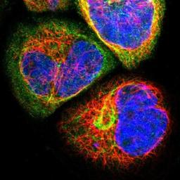 Immunocytochemistry/Immunofluorescence: WDR89 Antibody [NBP1-88413] - Staining of human cell line A-431 shows positivity in cytoplasm & cytoskeleton (intermediate filaments).