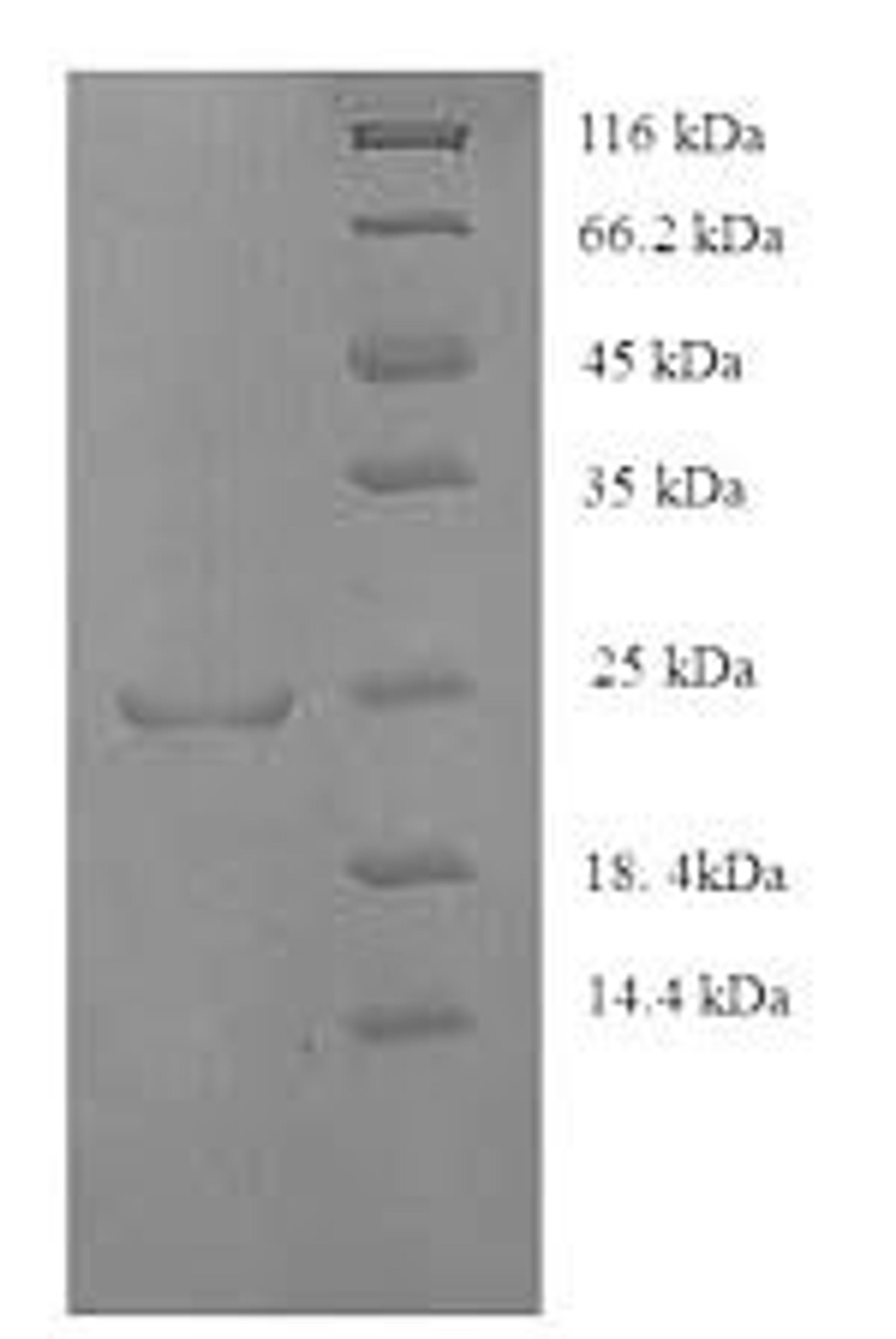 (Tris-Glycine gel) Discontinuous SDS-PAGE (reduced) with 5% enrichment gel and 15% separation gel.