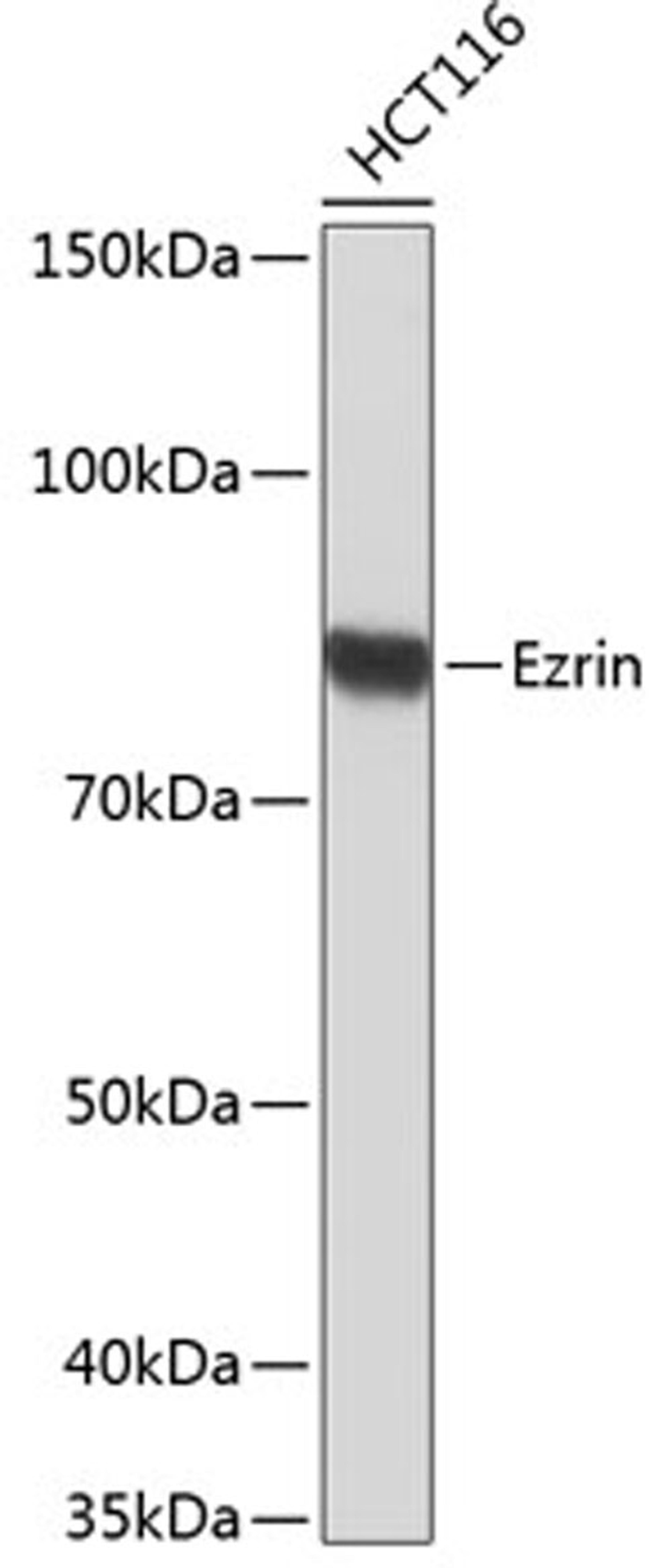 Western blot - Ezrin antibody (A19048)