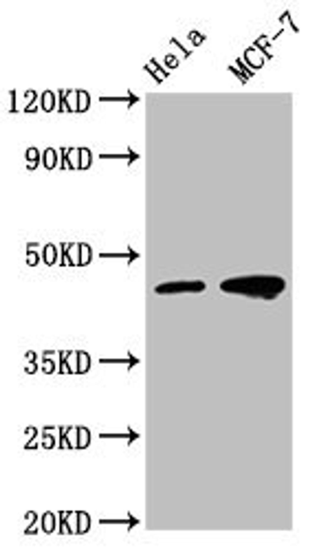 Western Blot. Positive WB detected in: Hela whole cell lysate, MCF-7 whole cell lysate . All lanes: TSG101 antibody at 1:500. Secondary. Goat polyclonal to mouse IgG at 1/50000 dilution. Predicted band size: 44, 32 KDa. Observed band size: 44 KDa. Exposure time：5min