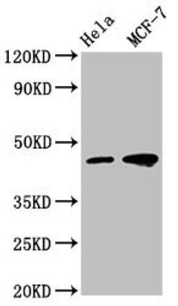 Western Blot. Positive WB detected in: Hela whole cell lysate, MCF-7 whole cell lysate . All lanes: TSG101 antibody at 1:500. Secondary. Goat polyclonal to mouse IgG at 1/50000 dilution. Predicted band size: 44, 32 KDa. Observed band size: 44 KDa. Exposure time：5min