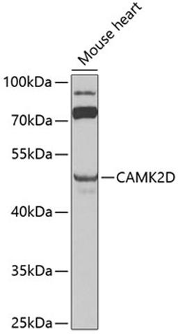 Western blot - CAMK2D antibody (A0656)