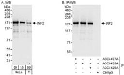 Detection of human INF2 by western blot and immunoprecipitation.