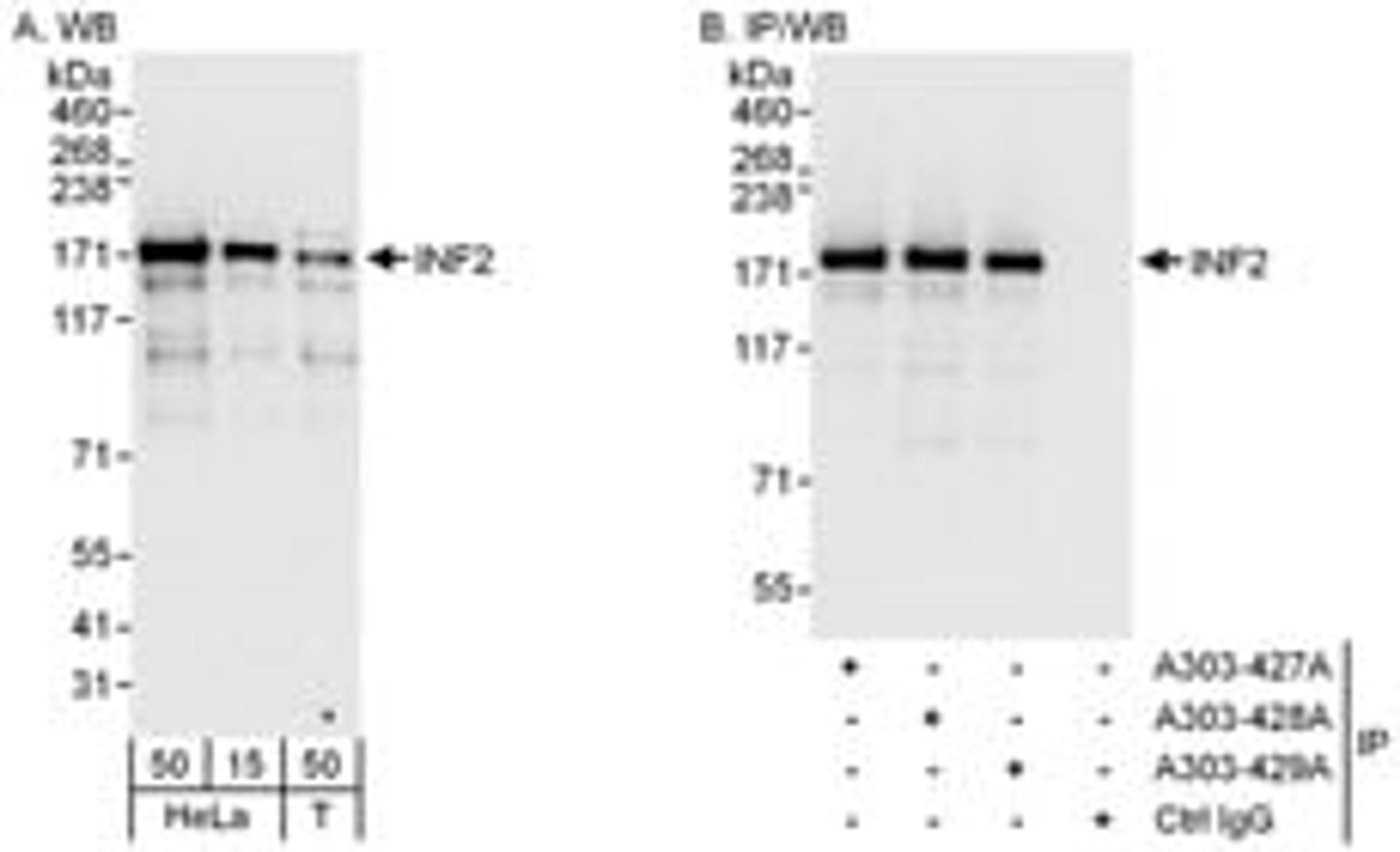 Detection of human INF2 by western blot and immunoprecipitation.