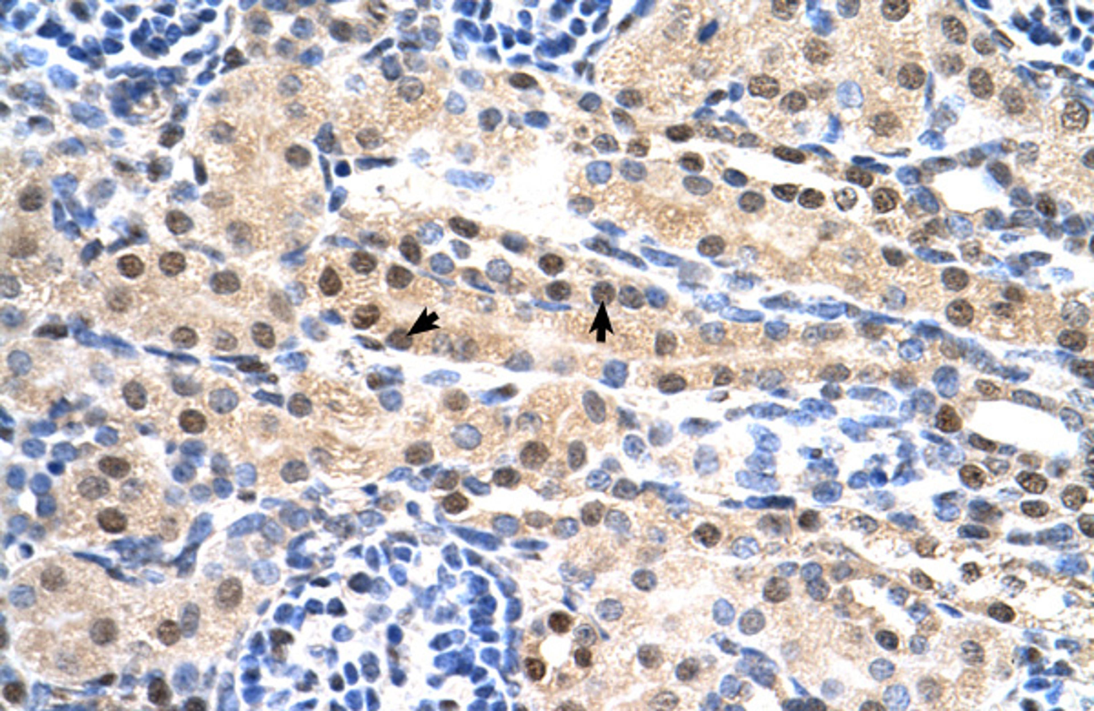 Antibody used in IHC on Human kidney.