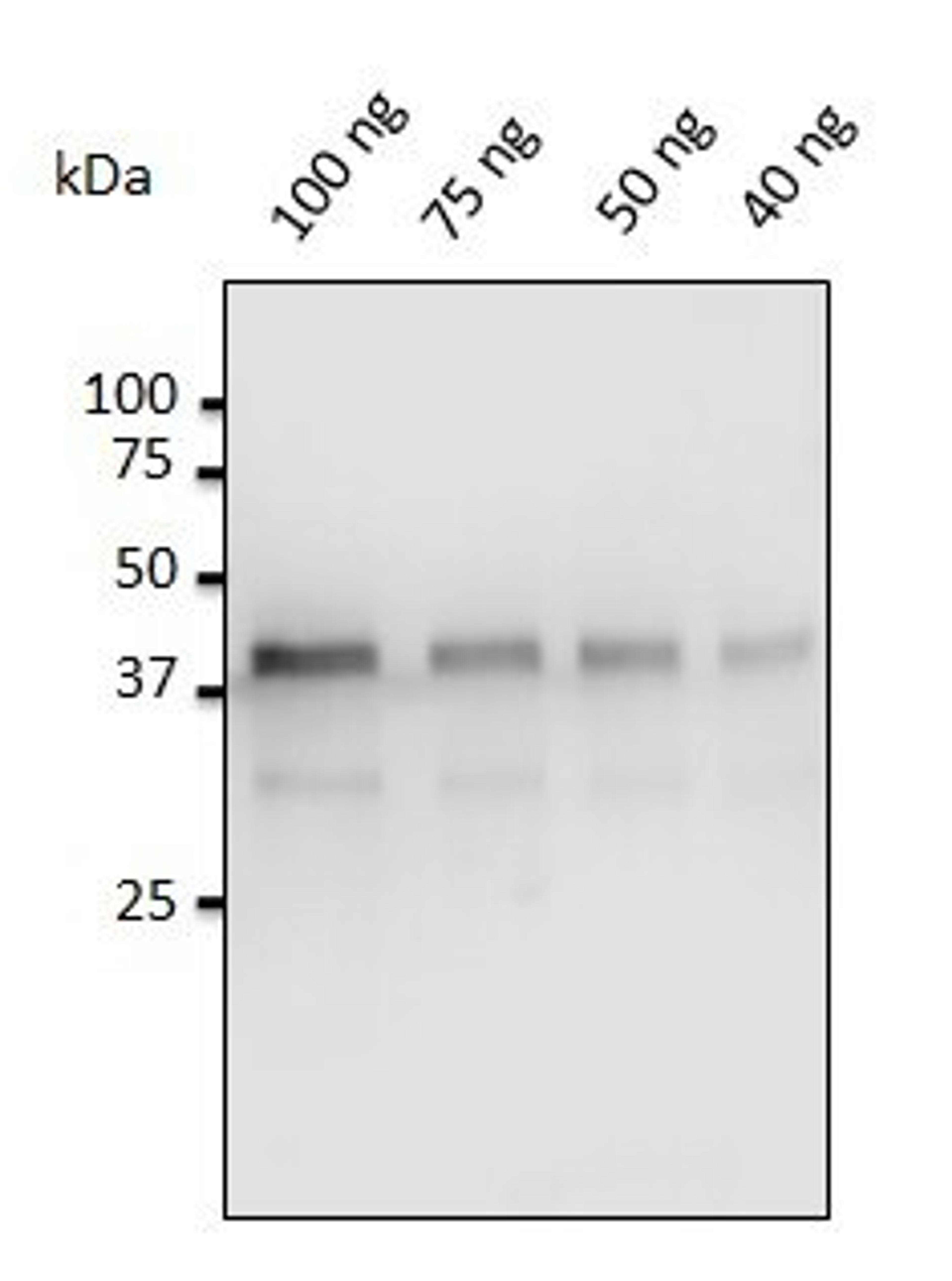 Western blot analysis of staining of porcine gastric mucosa using Pepsin antibody