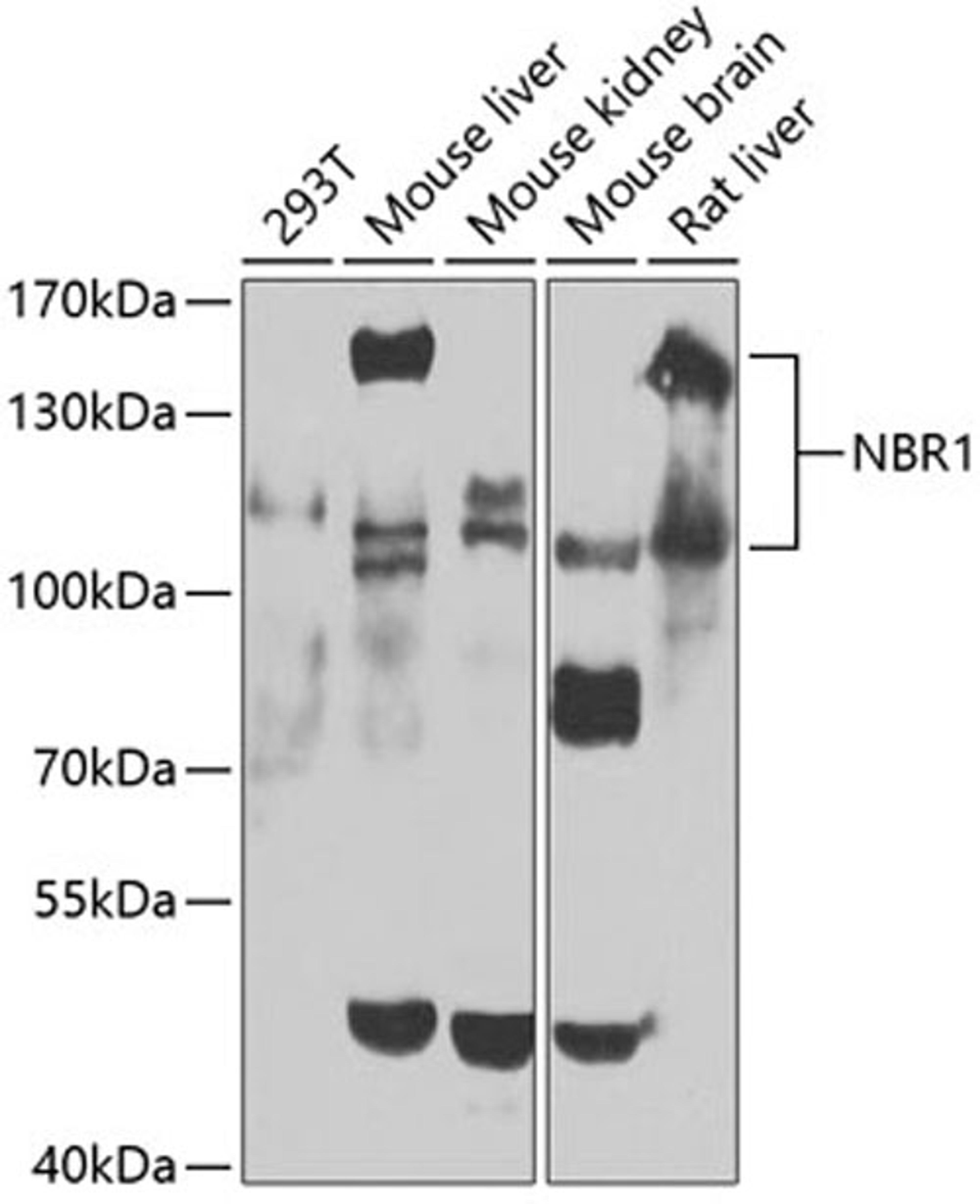 Western blot - NBR1 antibody (A3949)