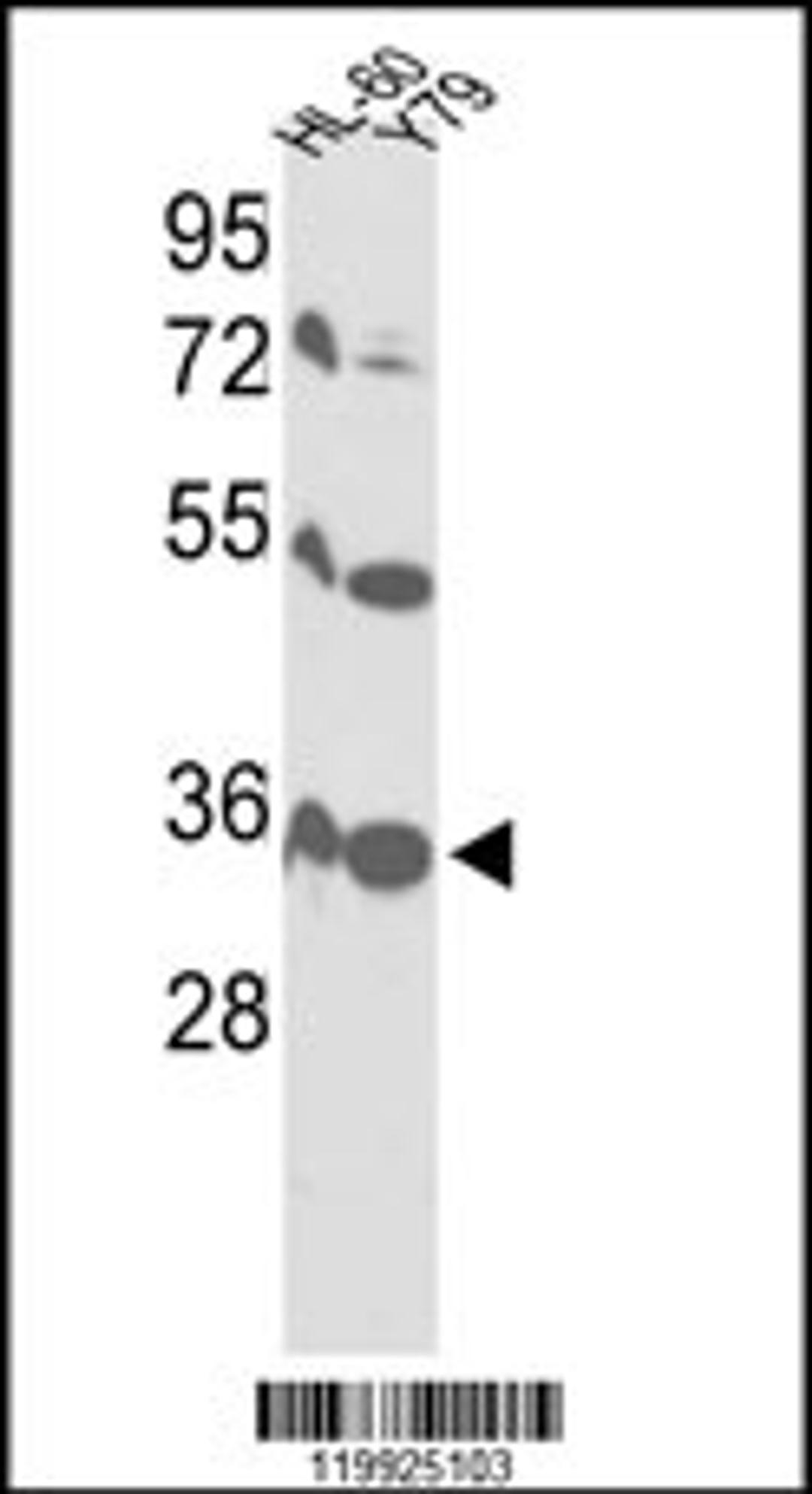 Western blot analysis of VDAC1 Antibody in HL-60, Y79 cell line lysates (35ug/lane)