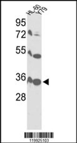 Western blot analysis of VDAC1 Antibody in HL-60, Y79 cell line lysates (35ug/lane)