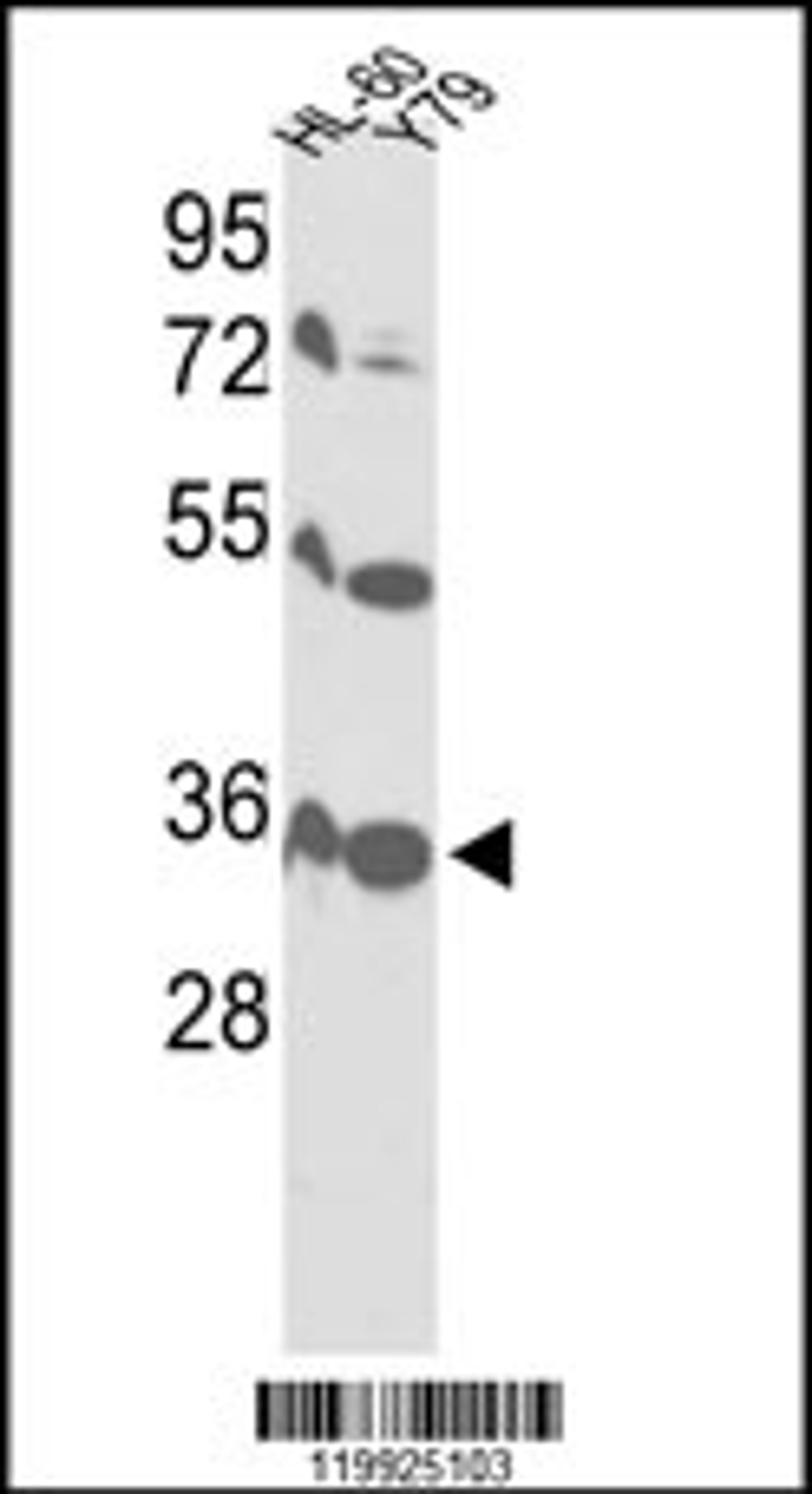 Western blot analysis of VDAC1 Antibody in HL-60, Y79 cell line lysates (35ug/lane)