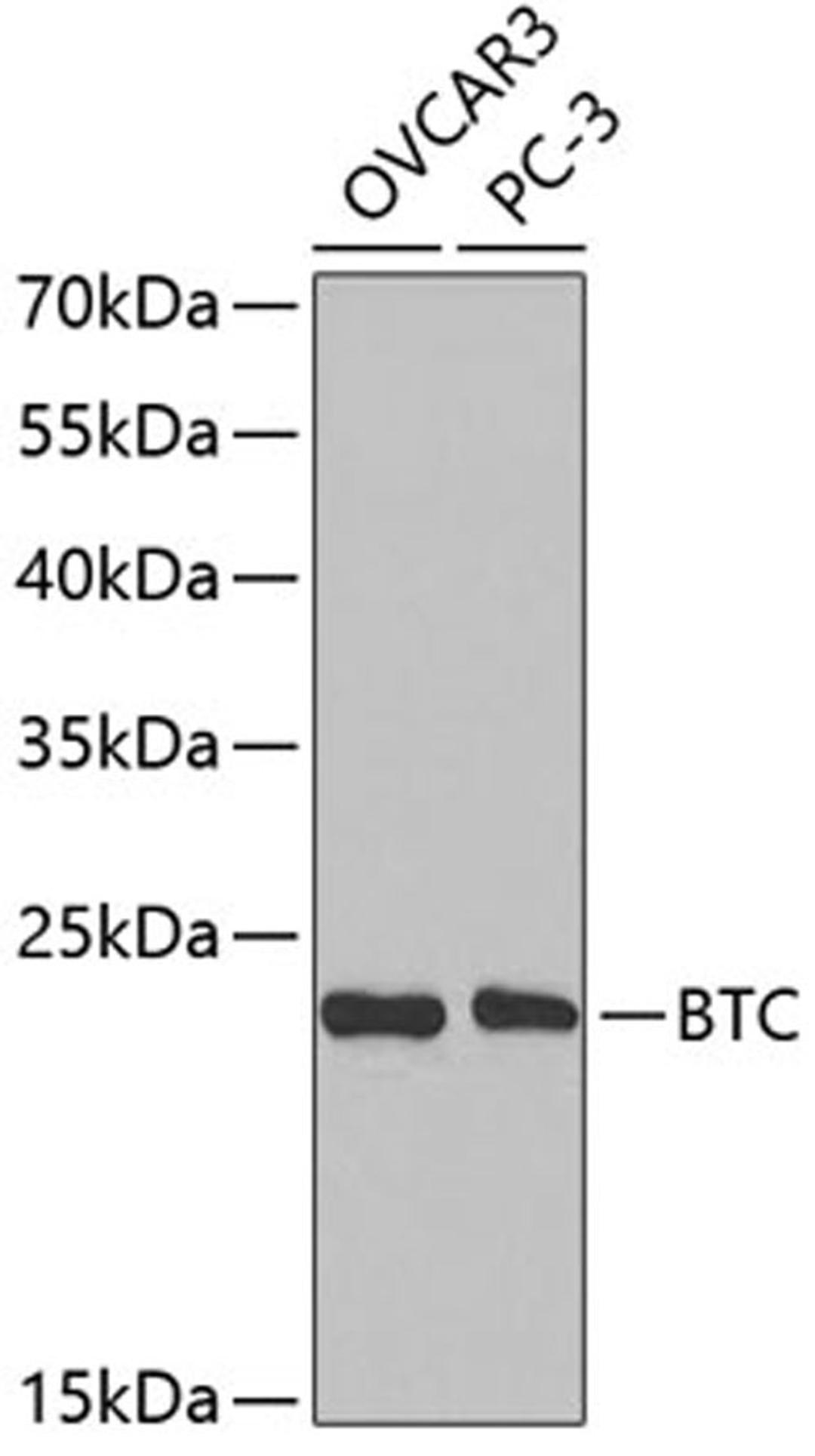 Western blot - BTC antibody (A2588)