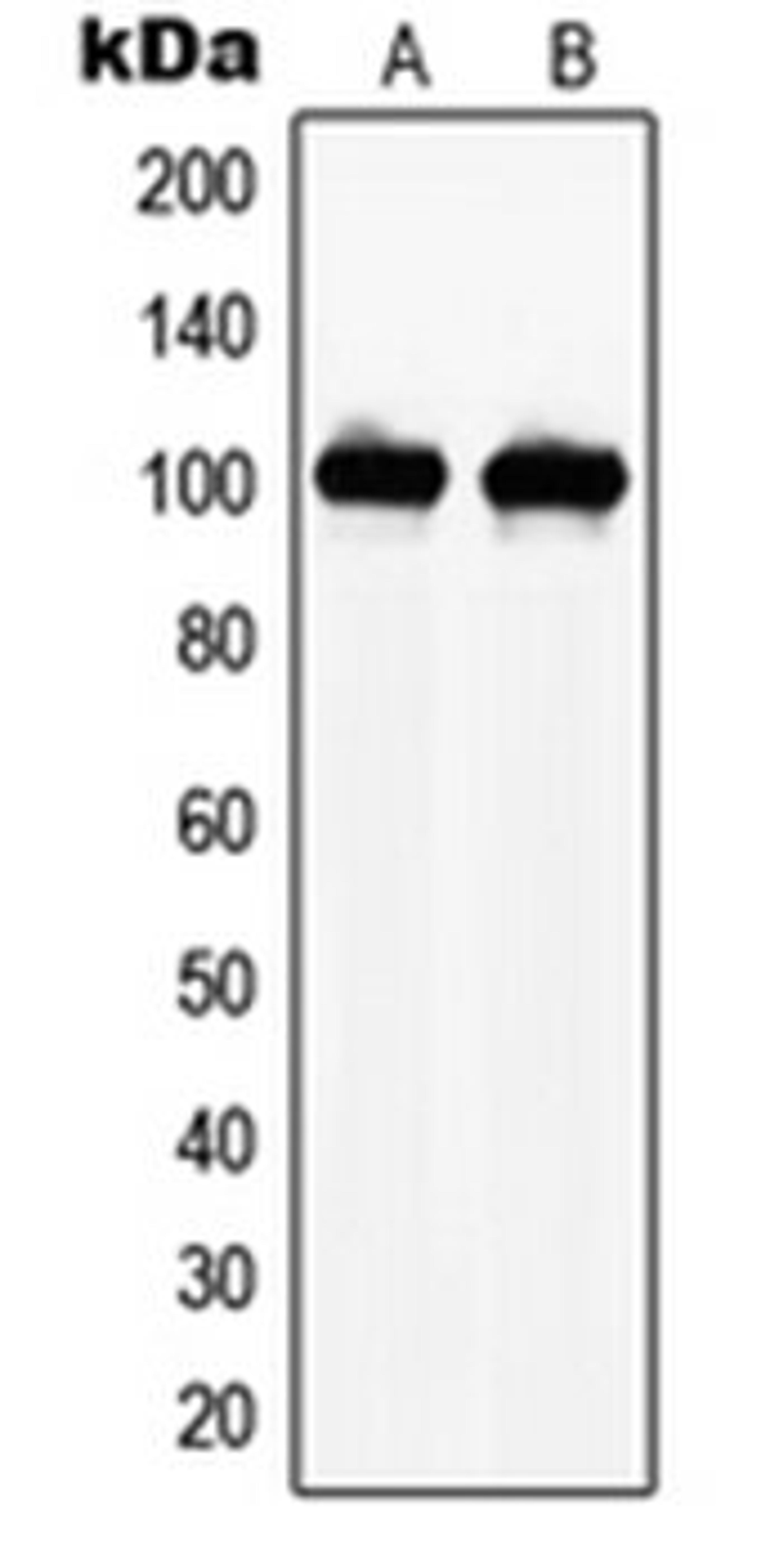 Western blot analysis of THP1 (Lane 1), HEK293 (Lane 2) whole cell lysates using NAA15 antibody