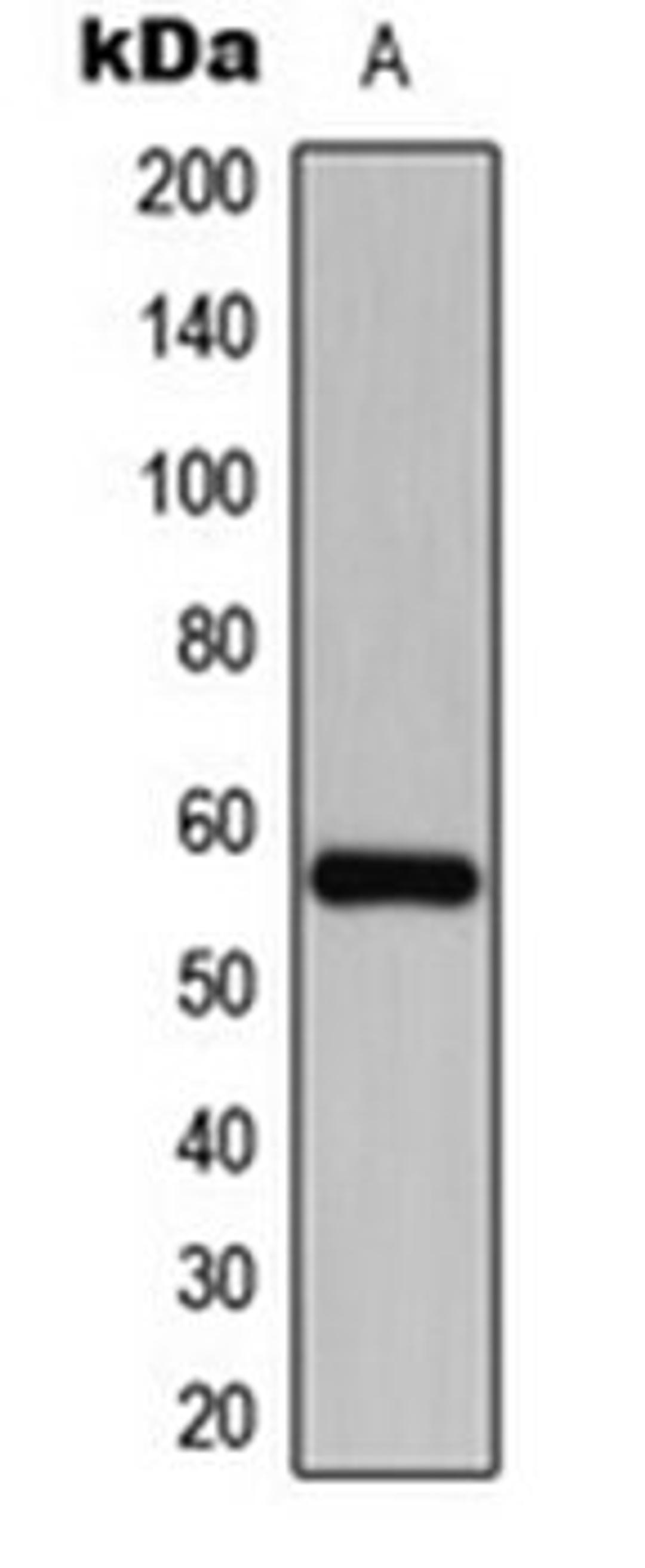 Western blot analysis of SHSYSY (Lane 1) whole cell lysates using CDKL2 antibody