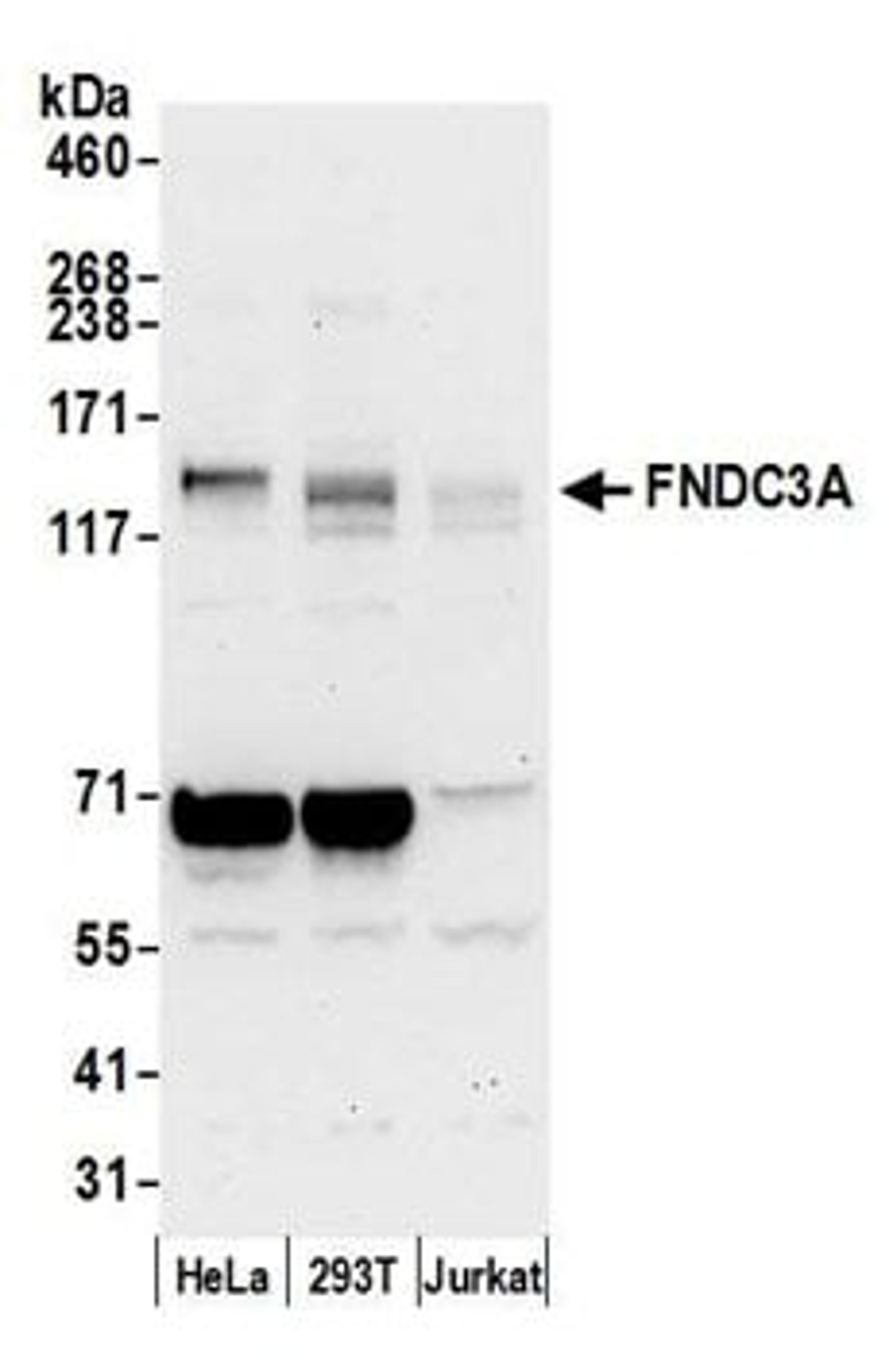 Detection of human FNDC3A by western blot.