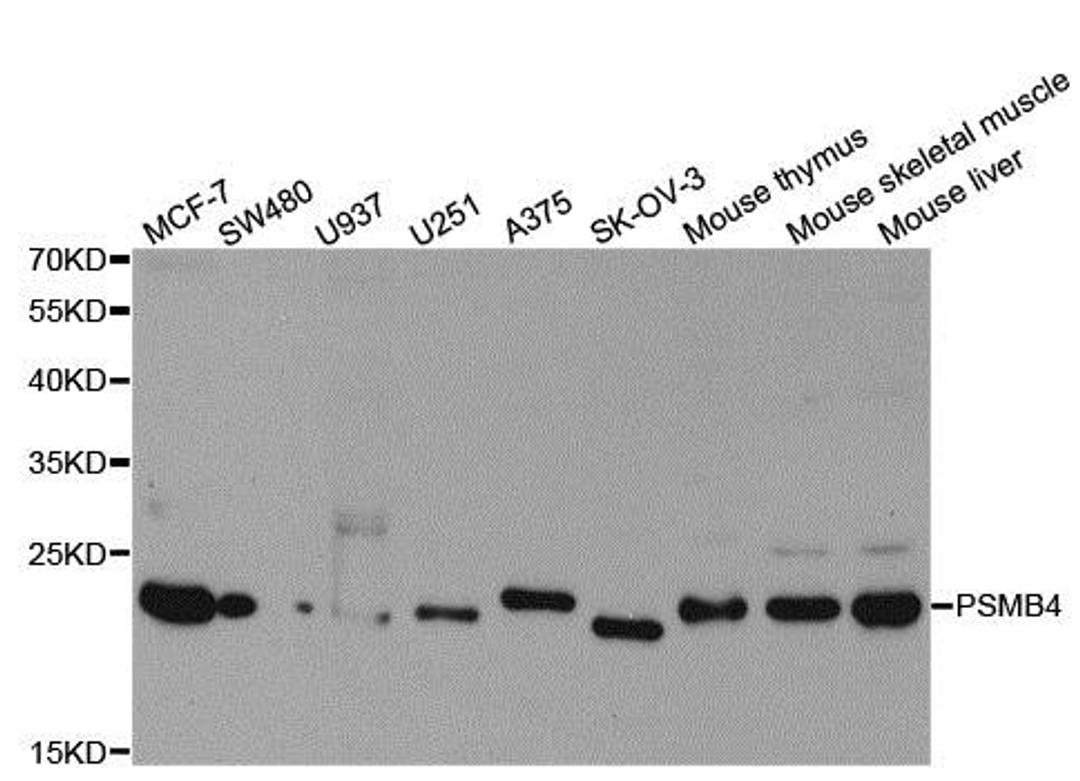 Western blot analysis of extracts of various cell lines using PSMB4 antibody