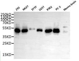 Western Blot. Positive WB detected in: Mouse liver tissue, Mouse brain tissue. All lanes: METTL2A antibody at 3ug/ml. Secondary. Goat polyclonal to rabbit IgG at 1/50000 dilution. Predicted band size: 44, 28 kDa. Observed band size: 44 kDa.