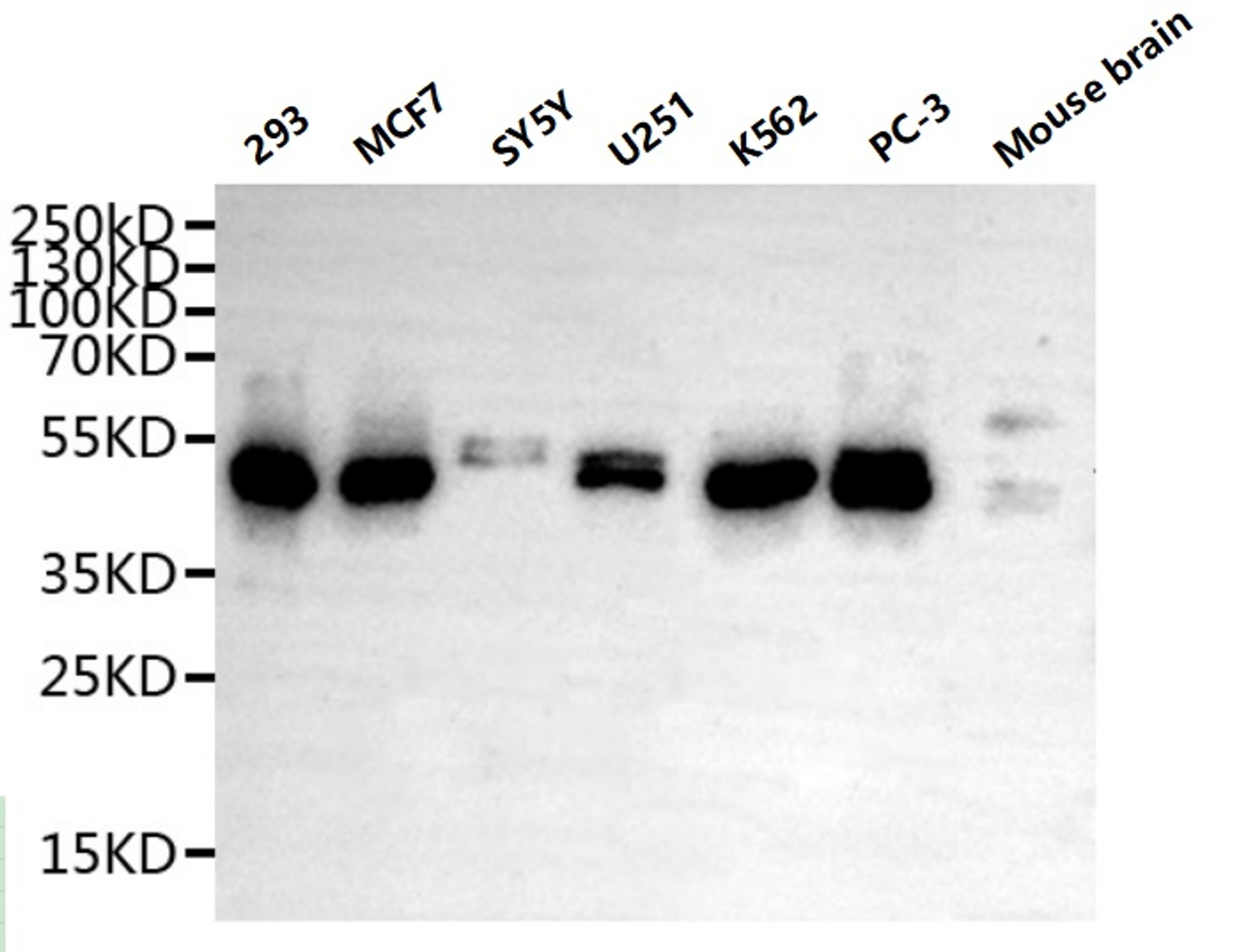 Western Blot. Positive WB detected in: Mouse liver tissue, Mouse brain tissue. All lanes: METTL2A antibody at 3ug/ml. Secondary. Goat polyclonal to rabbit IgG at 1/50000 dilution. Predicted band size: 44, 28 kDa. Observed band size: 44 kDa.