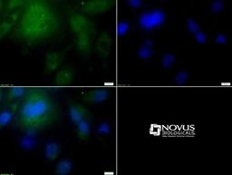 Immunocytochemistry/Immunofluorescence: Lipase A Antibody [NBP1-54155] - ICC staining of LIPA in HepG2 cells with FITC (green). Nuclei were counterstained with Dapi (blue).