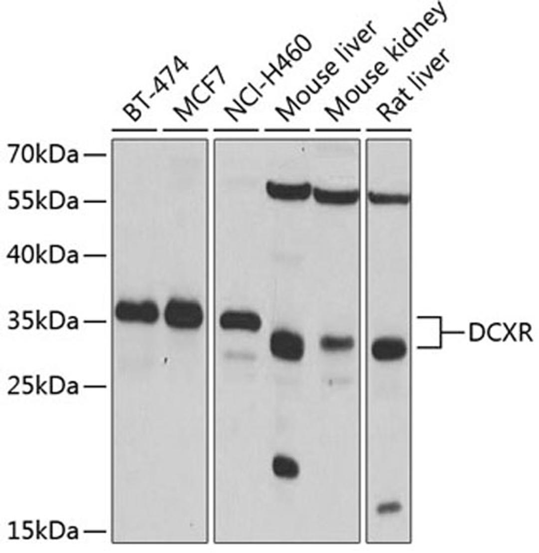 Western blot - DCXR antibody (A4721)