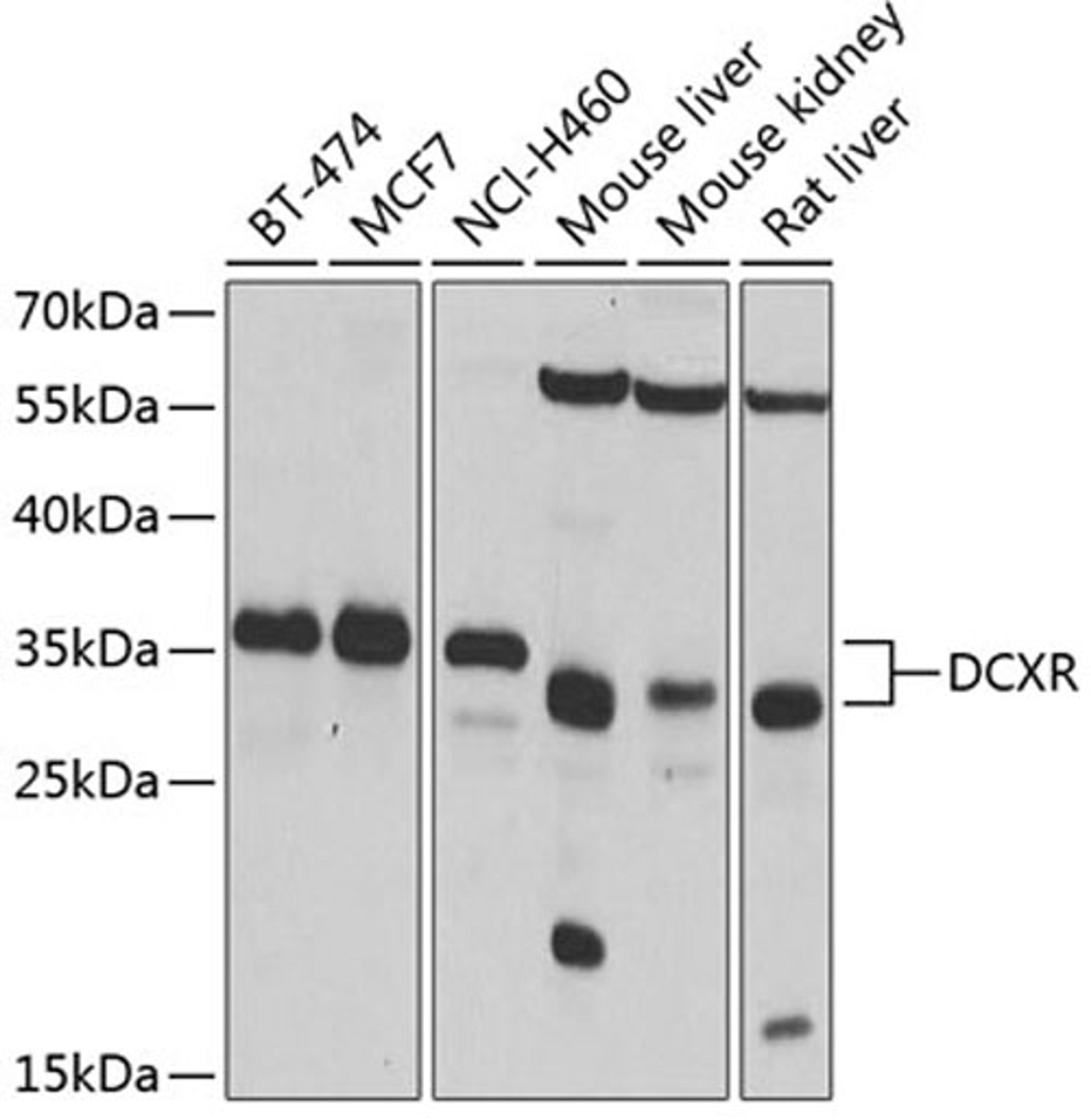 Western blot - DCXR antibody (A4721)