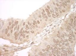 Detection of human JMY by immunohistochemistry.