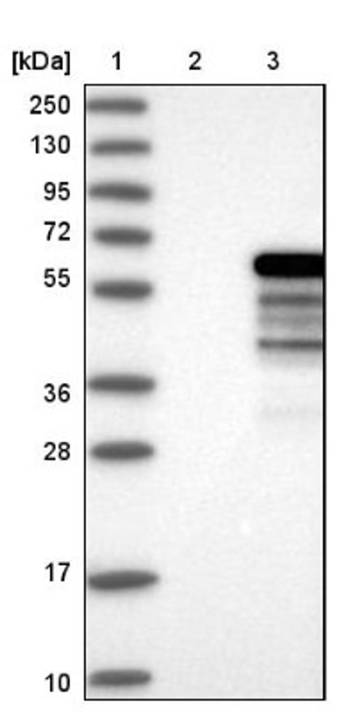 Western Blot: NAB1 Antibody [NBP1-86163] - Lane 1: Marker [kDa] 250, 130, 95, 72, 55, 36, 28, 17, 10<br/>Lane 2: Negative control (vector only transfected HEK293T lysate)<br/>Lane 3: Over-expression lysate (Co-expressed with a C-terminal myc-DDK tag (~3.1 kDa) in mammalian HEK293T cells, LY401805)