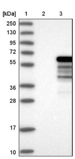 Western Blot: NAB1 Antibody [NBP1-86163] - Lane 1: Marker [kDa] 250, 130, 95, 72, 55, 36, 28, 17, 10<br/>Lane 2: Negative control (vector only transfected HEK293T lysate)<br/>Lane 3: Over-expression lysate (Co-expressed with a C-terminal myc-DDK tag (~3.1 kDa) in mammalian HEK293T cells, LY401805)