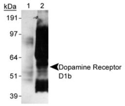 Western Blot: Dopamine Receptor D5 Antibody (SG4-D1b) [NB110-60019] - Detection of Dopamine Receptor D1a of Sf9 cells transfected with rat D1b.  Lane 1: Sf9-D1b lysate  Lane 2: Sf9-D1a lyate  (Please note that these results are similiar to those shown in J. Neuroimmunol. 101:170-187 publication.)