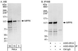 Detection of human MPP8 by western blot and immunoprecipitation.