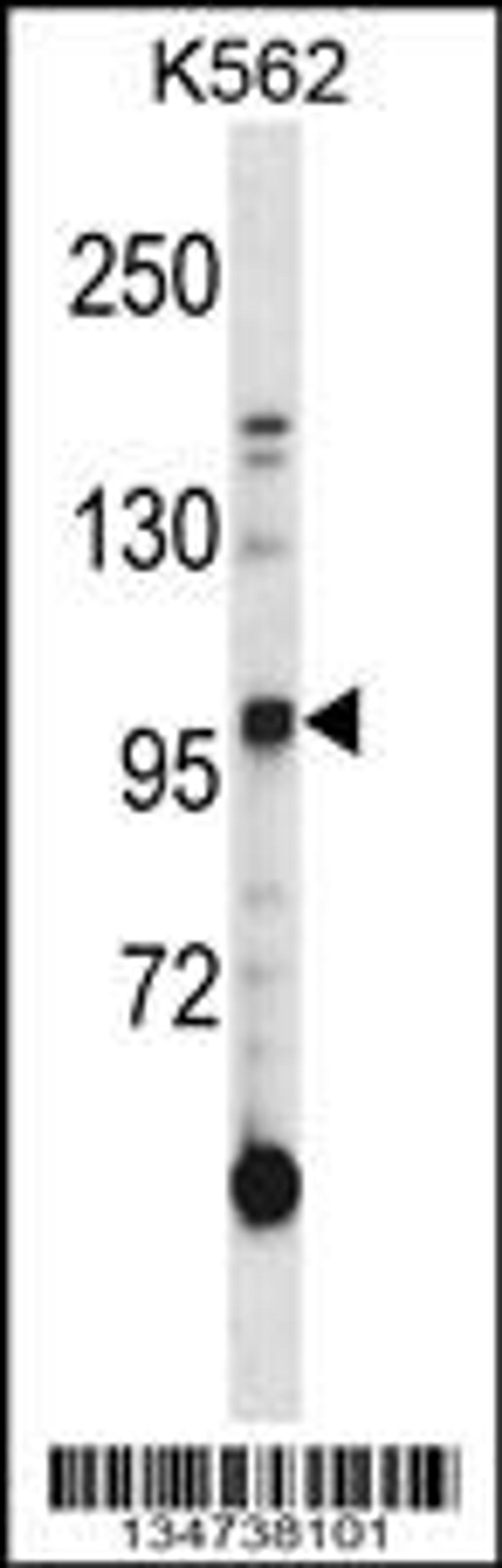 Western blot analysis in K562 cell line lysates (35ug/lane).This demonstratedetected the Axl protein (arrow).