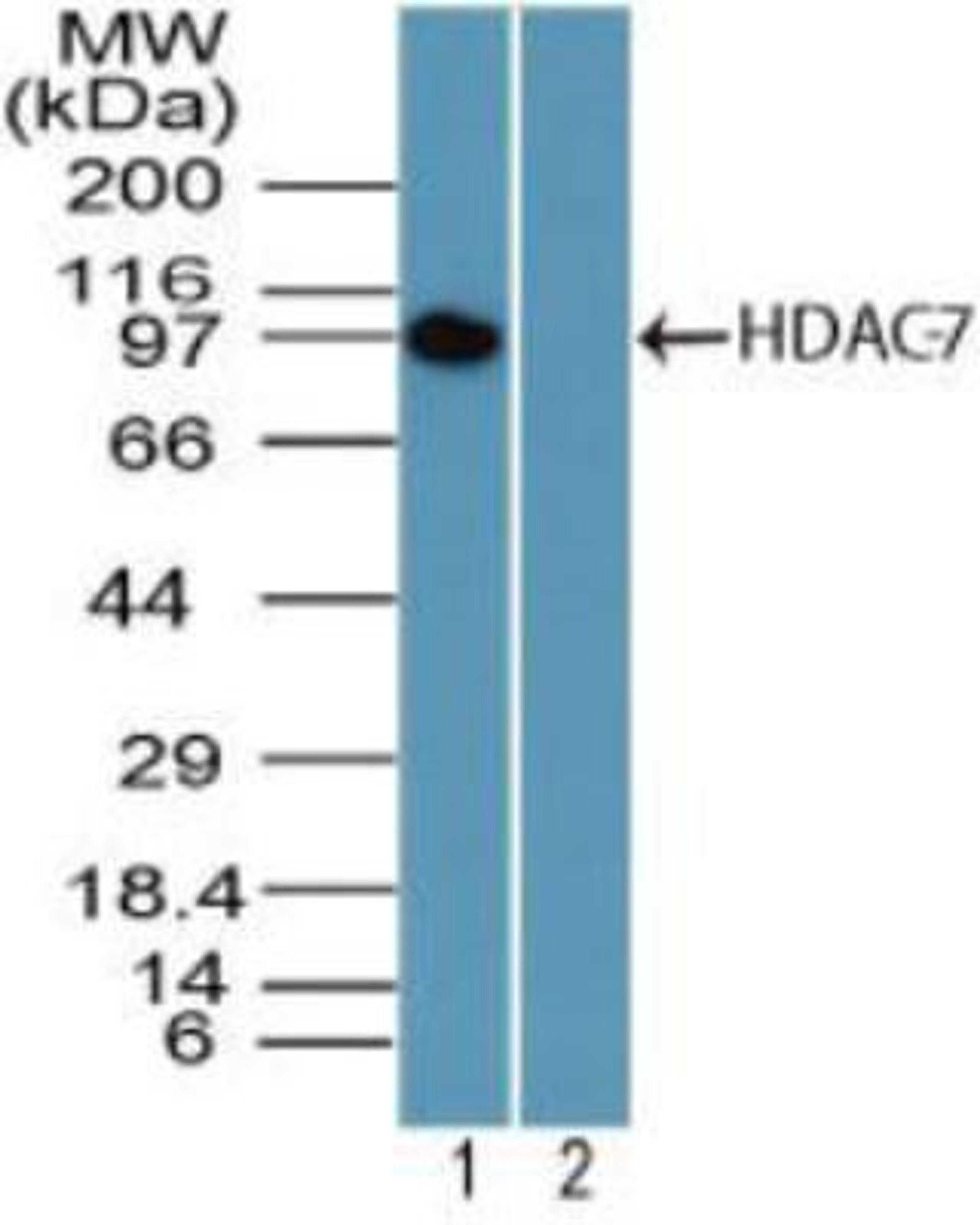 Western Blot: HDAC7 Antibody [NBP2-03974] - analysis of HDAC-7 using mouse placenta lysate in the 1) absence and 2) presence of immunizing peptide using  at 0.5 ug/ml.