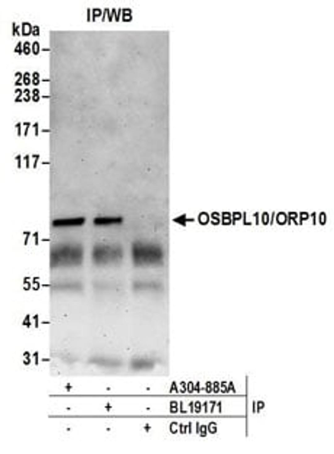 Detection of human OSBPL10/ORP10 by western blot of immunoprecipitates.