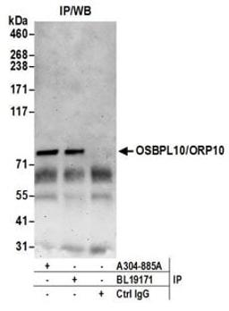 Detection of human OSBPL10/ORP10 by western blot of immunoprecipitates.