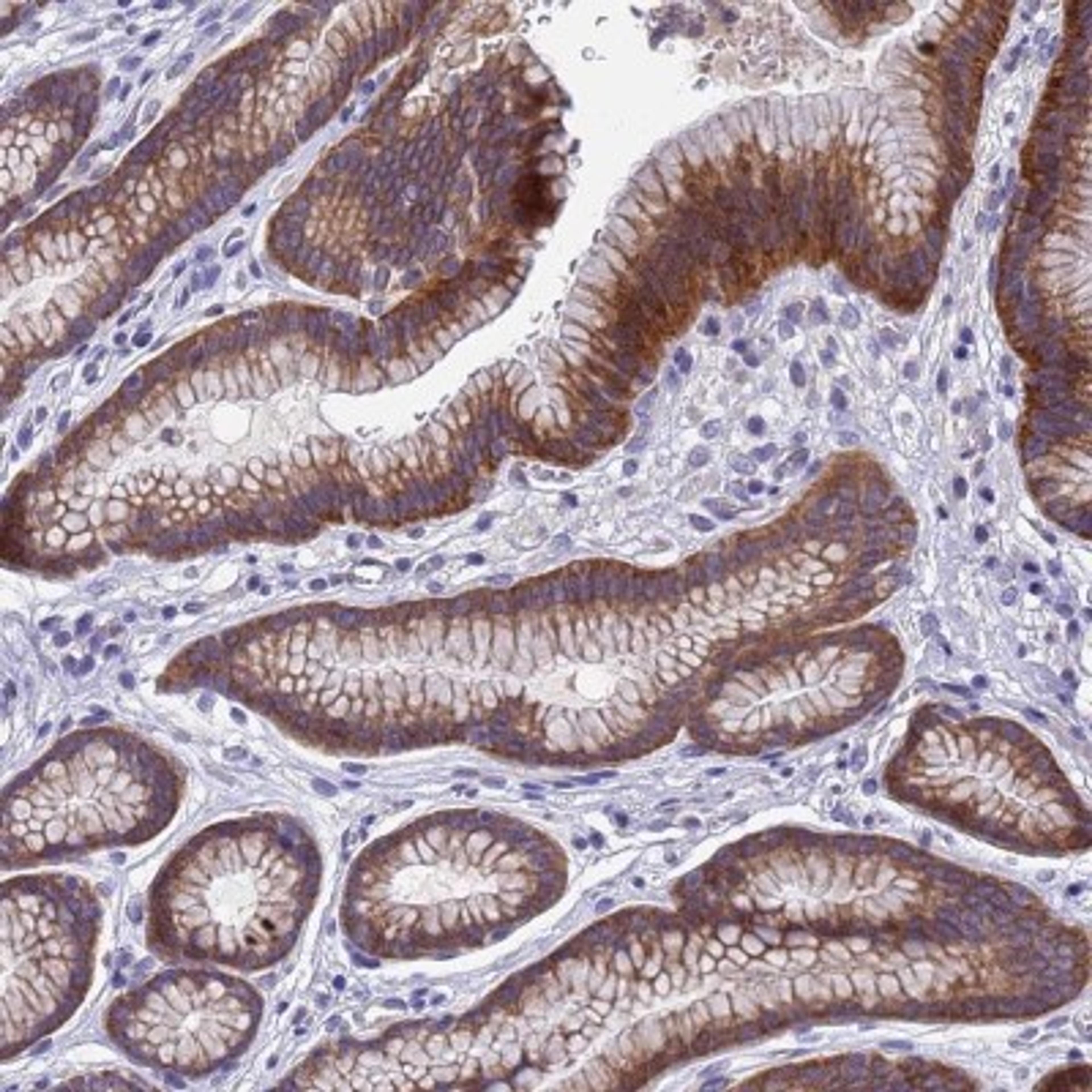 Immunohistochemistry-Paraffin: DCAF12L2 Antibody [NBP2-33428] - Immunohistochemical staining of human stomach, upper shows moderate cytoplasmic positivity in glandular cells.