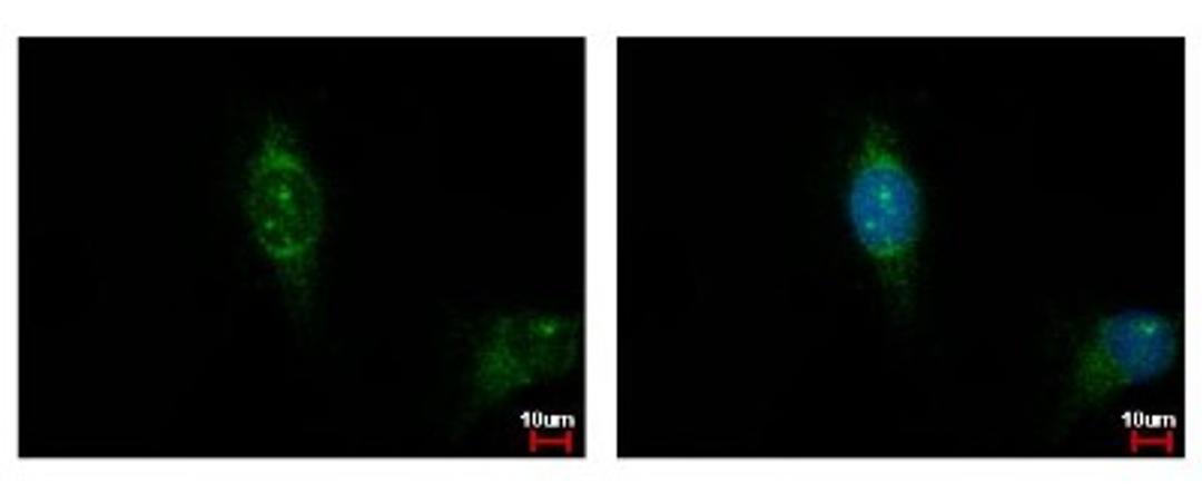 Immunocytochemistry/Immunofluorescence: CSNK1A1L Antibody [NBP2-16020] - Detection of CSNK1A1L protein at cytoplasm by immunofluorescent analysis. Sample: HeLa cells were fixed in iced-cold MeOH for 5 min. Green: CSNK1A1L protein stained by Casein Kinase 1 alpha 1L antibody diluted at 1:500. Blue: Hoechst 33342 staining.