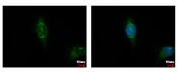 Immunocytochemistry/Immunofluorescence: CSNK1A1L Antibody [NBP2-16020] - Detection of CSNK1A1L protein at cytoplasm by immunofluorescent analysis. Sample: HeLa cells were fixed in iced-cold MeOH for 5 min. Green: CSNK1A1L protein stained by Casein Kinase 1 alpha 1L antibody diluted at 1:500. Blue: Hoechst 33342 staining.