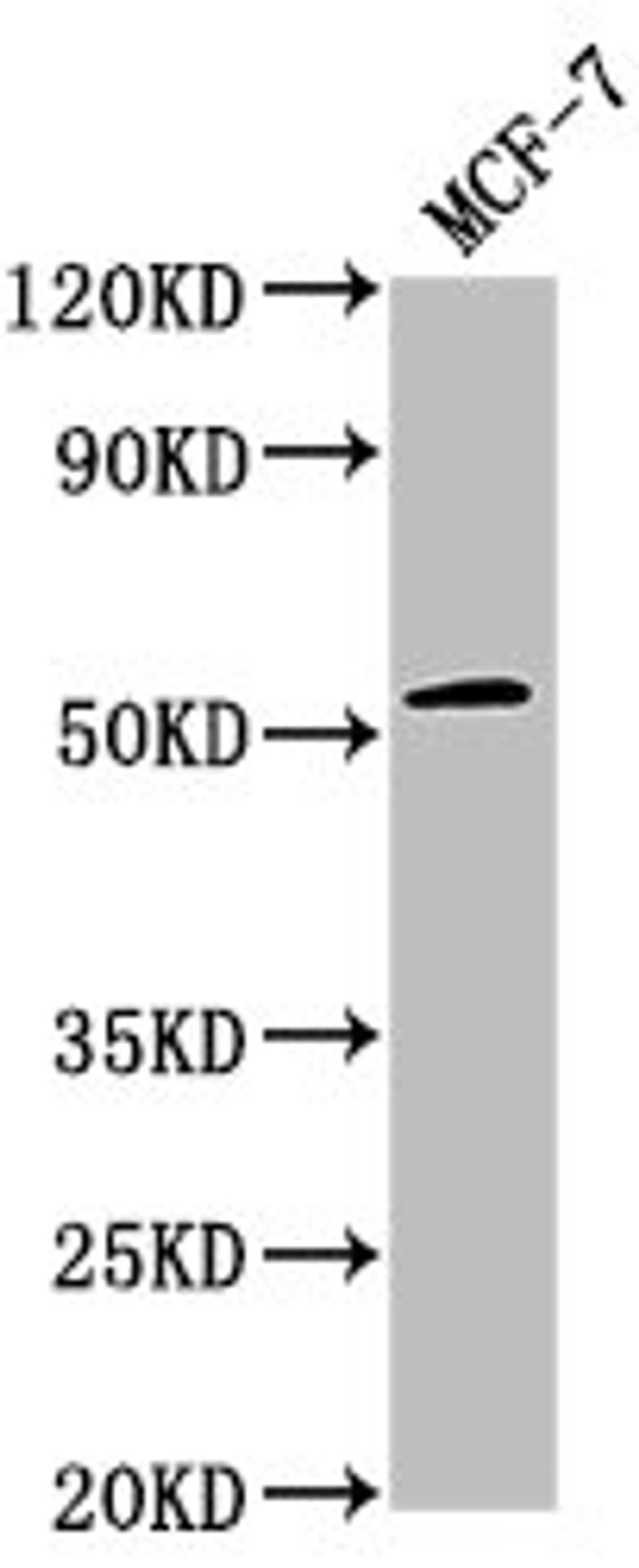 Western Blot. Positive WB detected in: MCF-7 whole cell lysate. All lanes: PPM1J antibody at 1:2000. Secondary. Goat polyclonal to rabbit IgG at 1/50000 dilution. Predicted band size: 55, 34 kDa. Observed band size: 55 kDa.